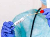 Examen PCR sin orden médica